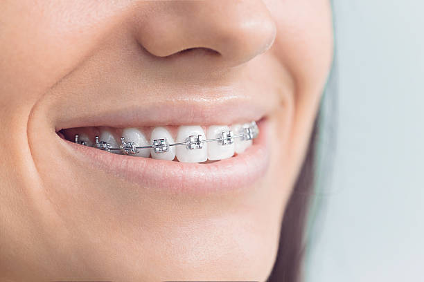 Best Invisalign and Clear Aligners  in Val Verde Park, TX